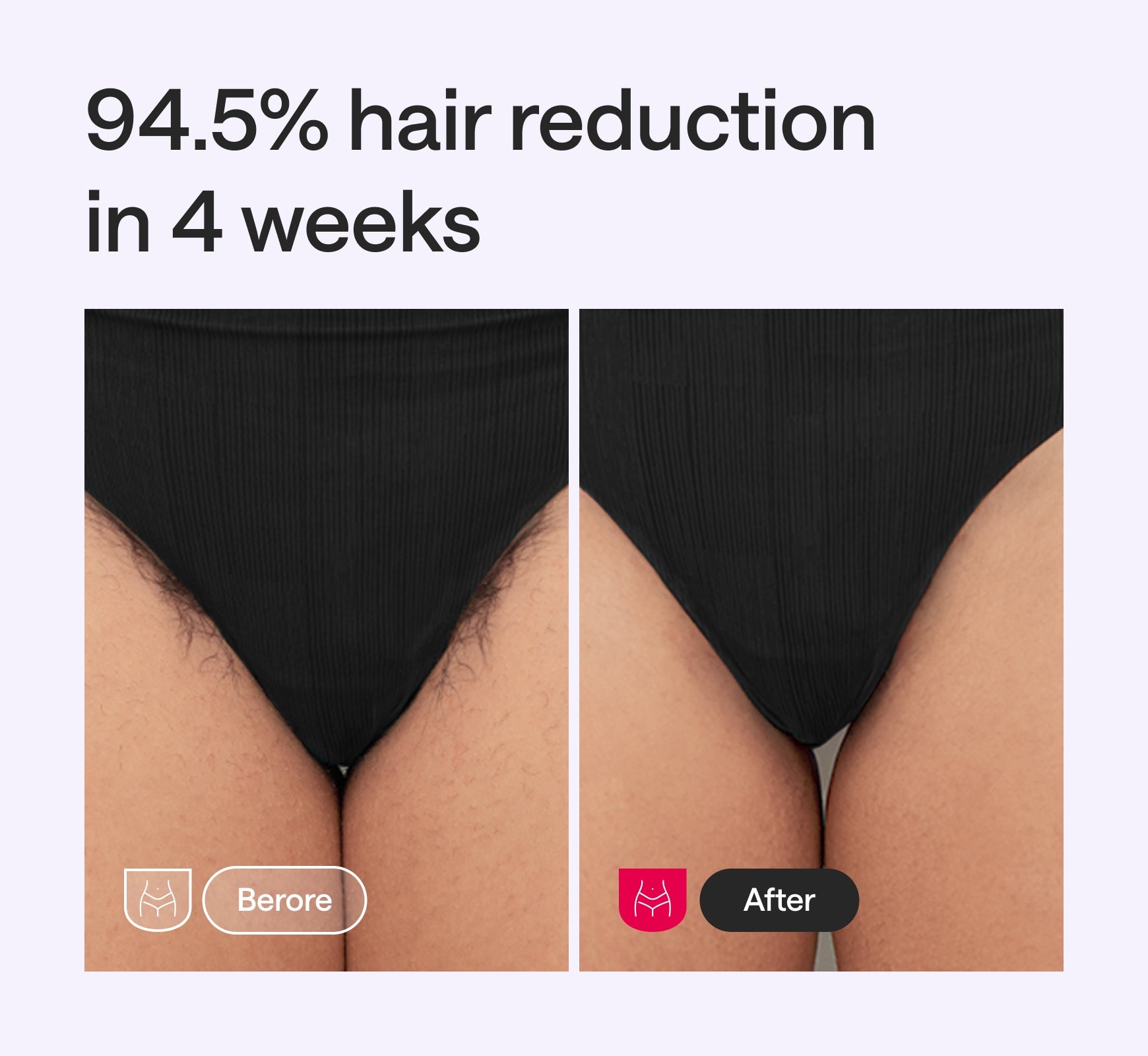 Ulike x Kuromi Air2 MAX Ice Cooling IPL Hair Removal Device